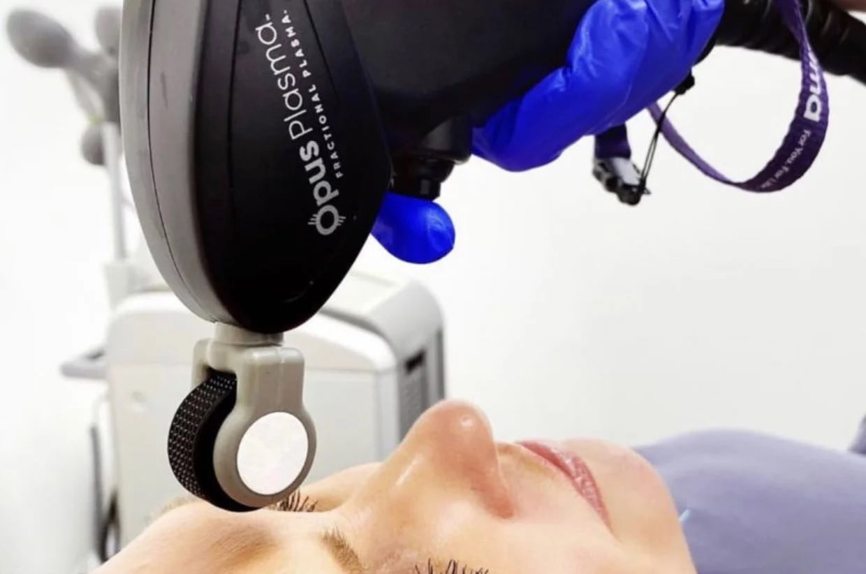 Opus laser Treatment | Cosmedics MedSpa in Lehi, UT