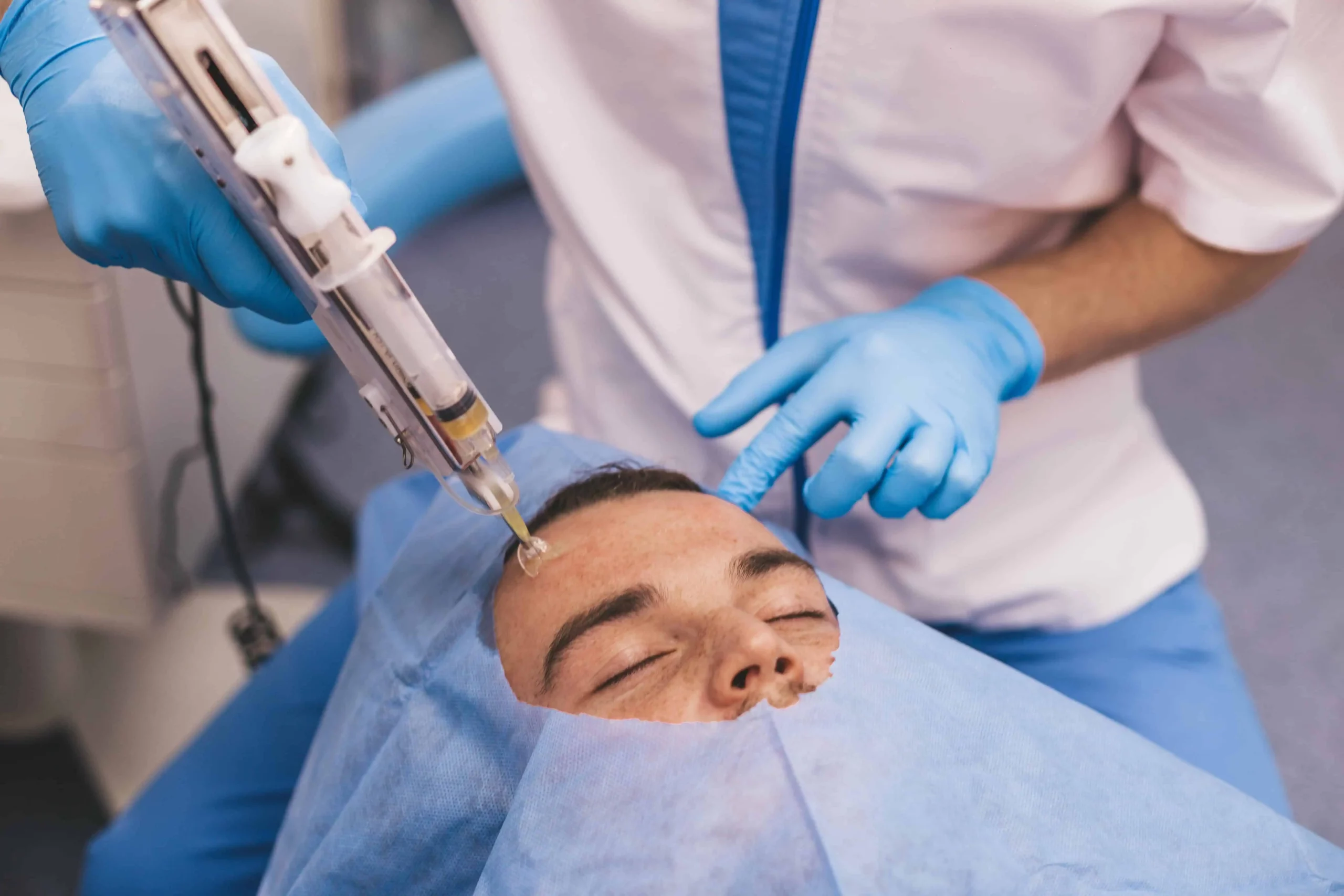 PRP Microneedling Rejuvenation scaled