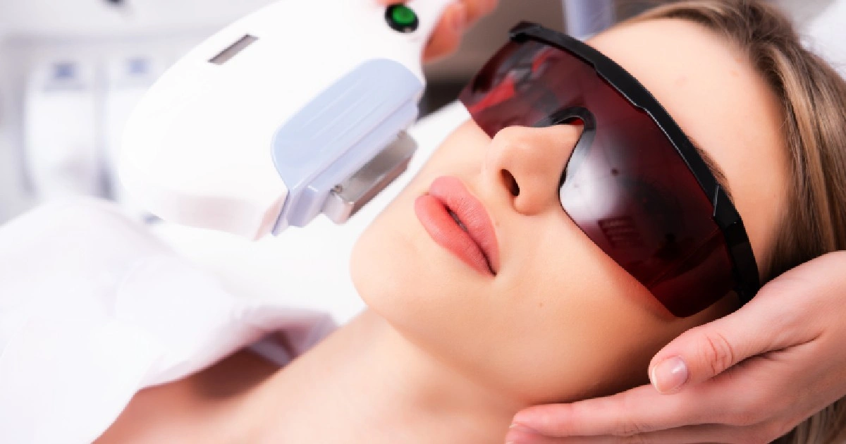 WomenreceivinaIPLPhotofacialTreatmentsinLehiUT